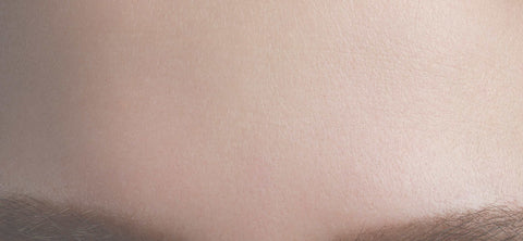 Normal skin