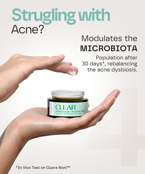 Clear Skin Moisturizer